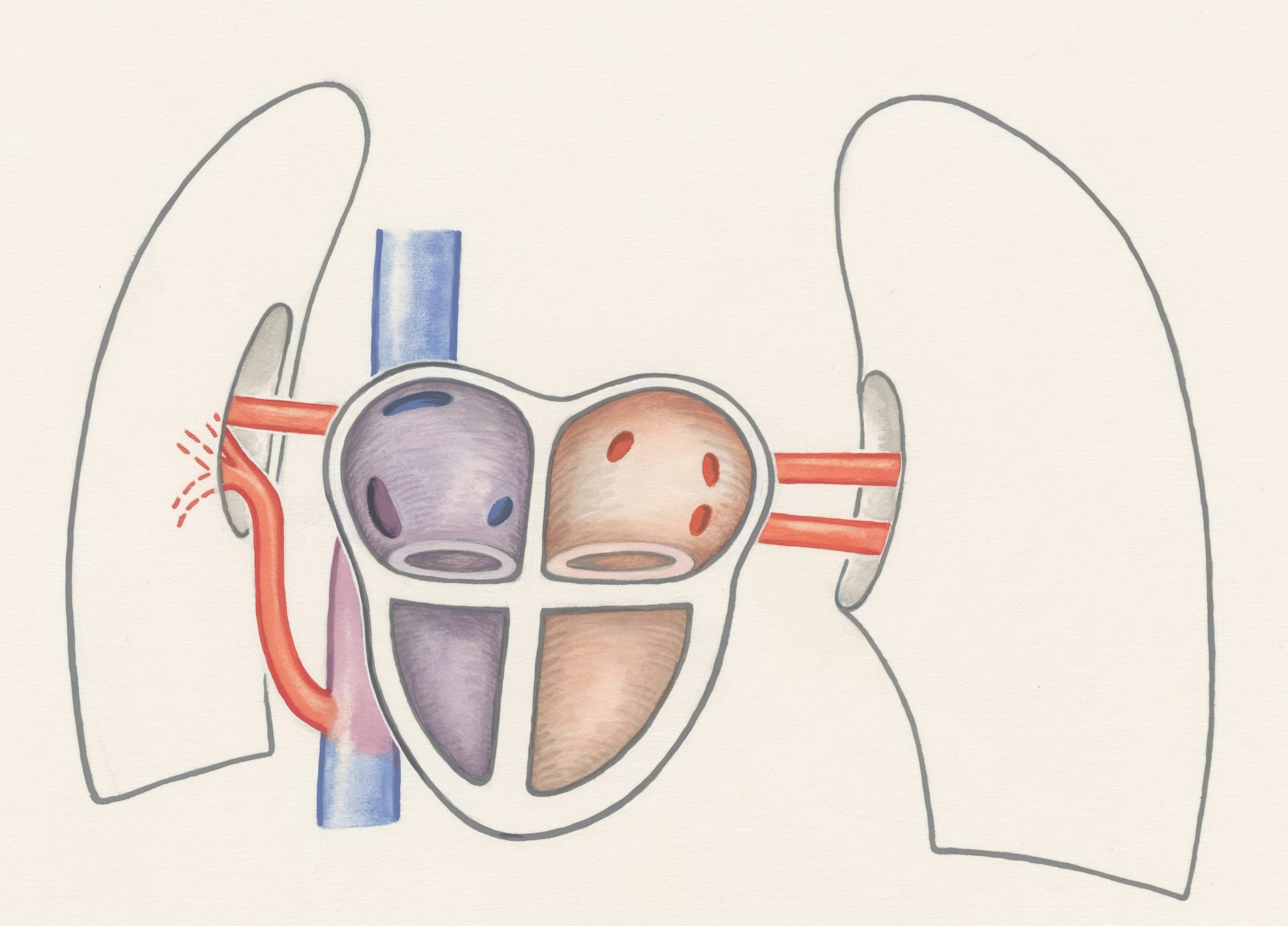 Diagram showing diaphragmatic vs. shallow breathing patterns.
