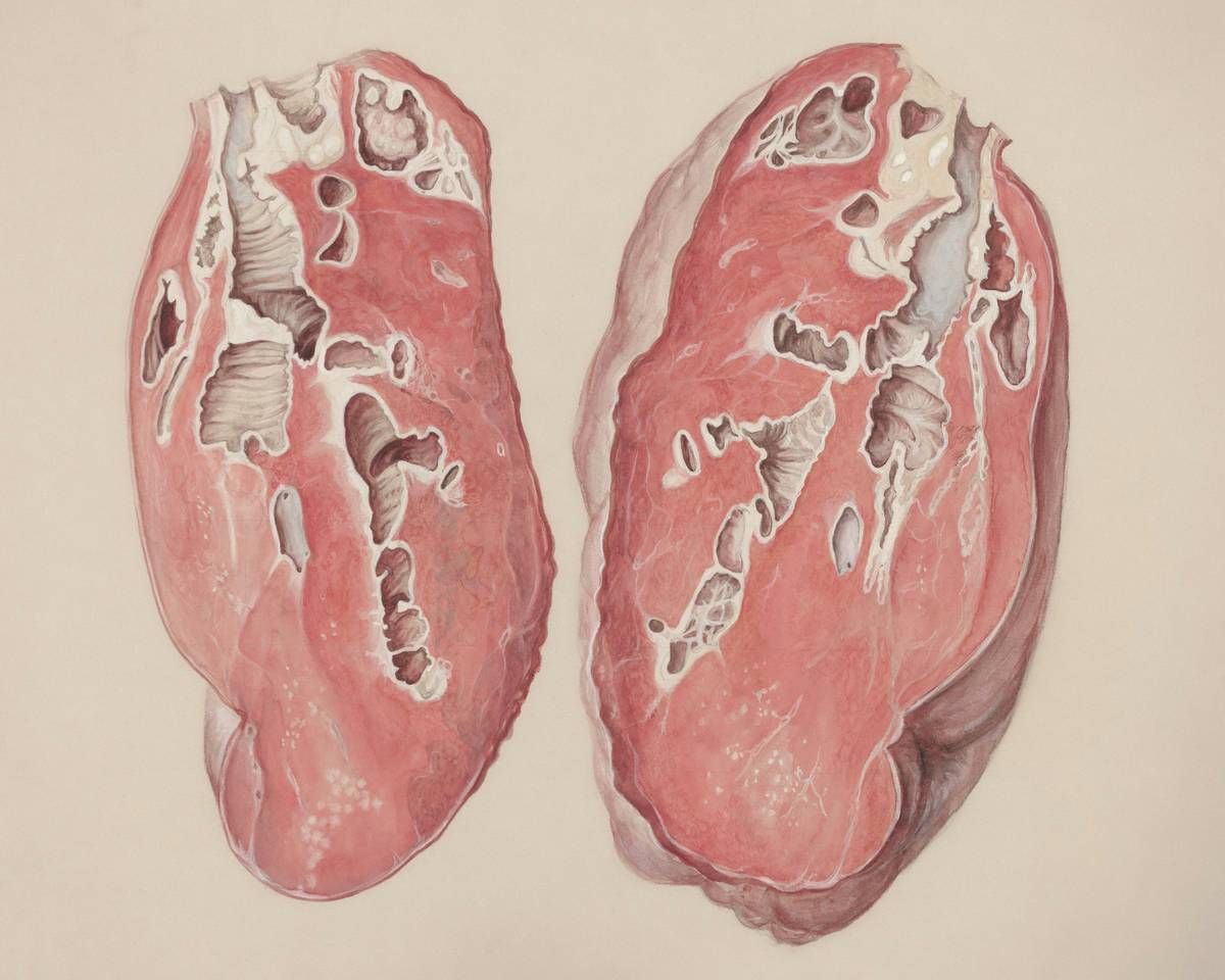 Comparison chart highlighting effective breathing practices